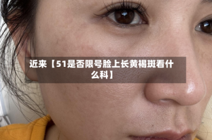 近来【51是否限号脸上长黄褐斑看什么科】